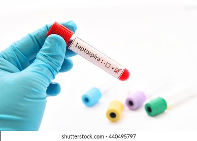 Blood Sample Positive With Leptospirosis Test