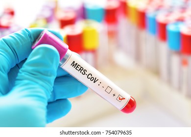 Blood Sample Positive With MERS-CoV (Middle East Respiratory Syndrome Coronavirus)