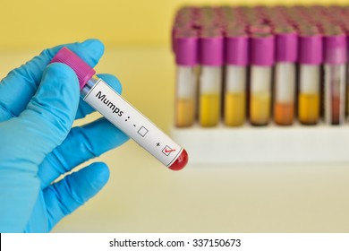 Blood Sample Positive With Mumps Virus 