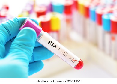 Blood sample positive with PSA (Prostate-specific antigen) test
