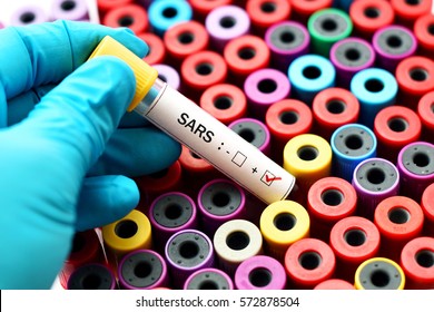 Blood Sample Positive With SARS Virus