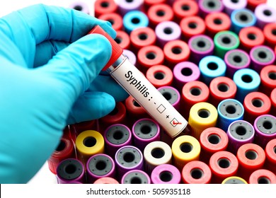 Blood Sample Positive With Syphilis
