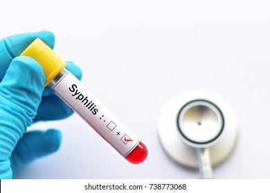 Blood Sample Positive With Syphilis 