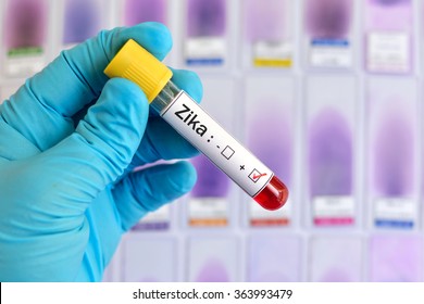 Blood Sample Positive With Zika Virus
