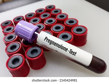 Blood Sample For Pregnenolone Test. To Help Detect And Monitor Treatment For Rare Types Of Genetic Conditions Such As Congenital Adrenal Hyperplasia (CAH)