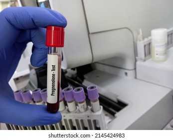 Blood Sample For Pregnenolone Test. To Help Detect And Monitor Treatment For Rare Types Of Genetic Conditions Such As Congenital Adrenal Hyperplasia (CAH)