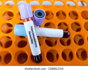 Blood Sample For Primary Immunodeficiency Diseases(PIDDs) Test.