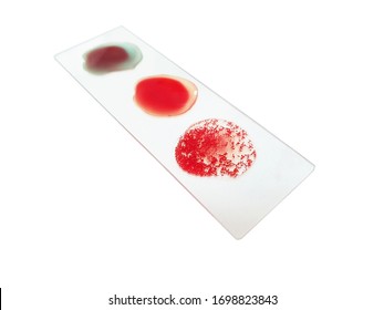 Blood sample in process of type test, Blood type, Clipping path