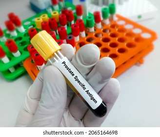 Blood sample for Prostate Specific Antigen (PSA) test, diagnosis for prostate cancer