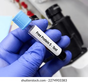 Blood sample for protein S test to diagnosis of coagulation disorder. Pulmonary embolism. protein S deficiency. - Shutterstock ID 2274903383