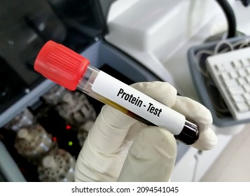 7,143 Protein testing Images, Stock Photos & Vectors | Shutterstock