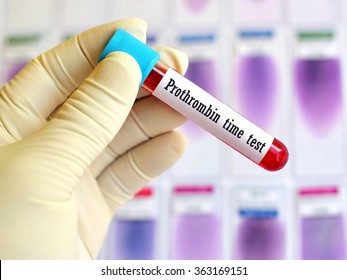 Blood Sample For Prothrombin Time Test (Blood Coagulation Testing)