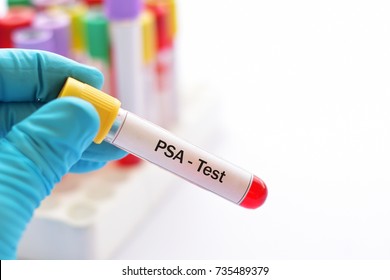Blood sample for PSA (prostate specific antigen) test, diagnosis for prostate cancer