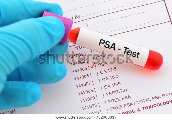 examen de próstata psa y philco