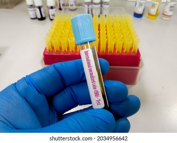 Blood Sample For PTINR Test (Blood Coagulation Testing)