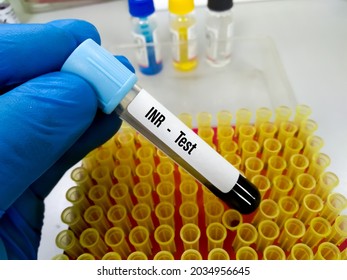 Blood Sample For PTINR Test (Blood Coagulation Testing)