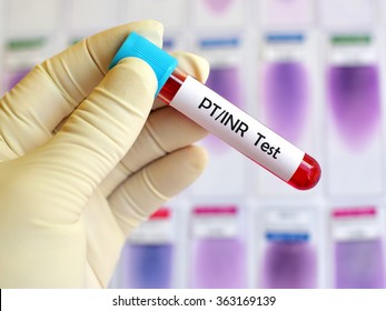 Blood Sample For PT/INR Test (Blood Coagulation Testing)