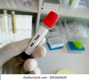 Blood Sample For RA Test. Rheumatoid Factor, Rheumatoid Arthritis