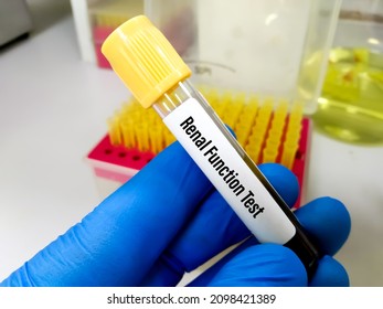 Blood Sample For Renal Function Test