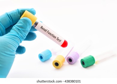 Blood Sample For Renal Function Test