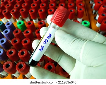 Blood sample with requisition form for anti-TPO, aTPO test. For autoimmune disease diagnosis