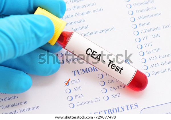 Blood Sample Requisition Form Cea Test Stock Photo Edit Now