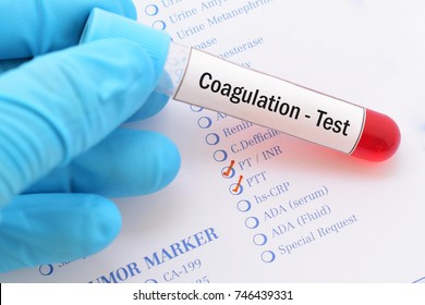 Blood Sample With Requisition Form For Coagulation Test