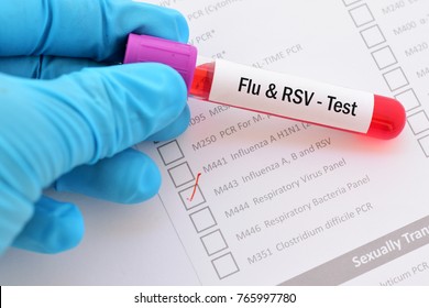 Blood Sample With Requisition Form For Flu And RSV Test