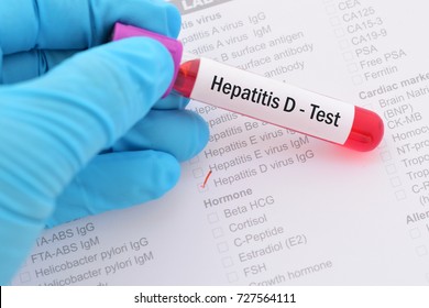 Blood Sample With Requisition Form For Hepatitis D Virus Test
