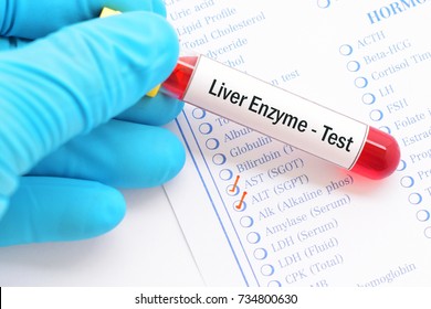 Blood Sample With Requisition Form For Liver Enzyme (AST, ALT) Test