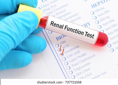 Blood Sample With Requisition Form For Renal Function Test