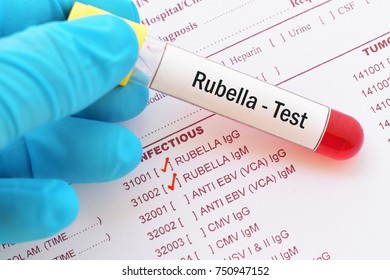 Blood Sample With Requisition Form For Rubella Virus Test