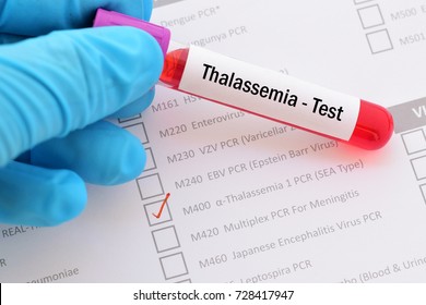 Talesemia Thalassemias