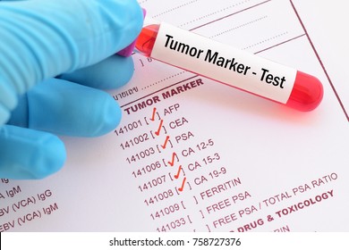 Blood Sample With Requisition Form For Tumor Marker Test
