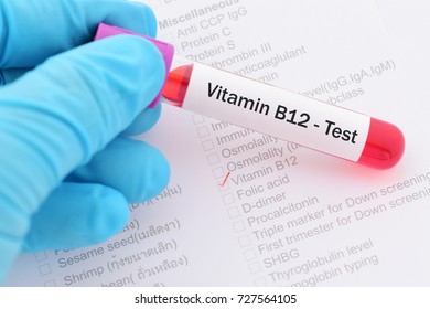 Blood Sample With Requisition Form For Vitamin B12 Test
