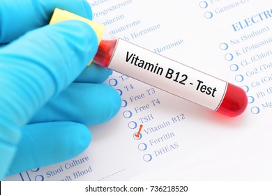 Blood sample with requisition form for vitamin B12 test