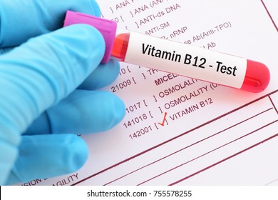 Blood sample with requisition form for vitamin B12 test
