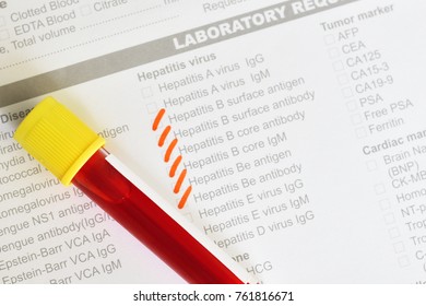 Blood Sample With Requisition Form For Vitamin B12 Test