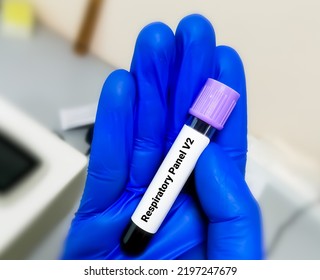 Blood Sample For Respiratory Panel V2 Test.