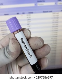 Blood Sample For Respiratory Panel V2 Test.