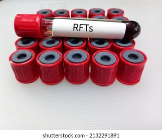 Blood Sample For RFTs(Renal Function Tests), Kidney Function Tests(KFTs), Selective Focus