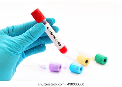 Blood Sample For Rubella Virus Test, German Measles Diagnosis