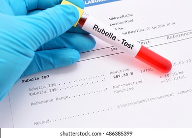 Blood Sample For Rubella Virus Test With Result
