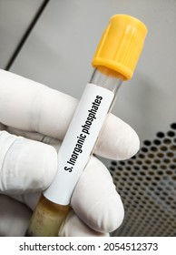 Blood Sample For S. Inorganic Phosphates Test