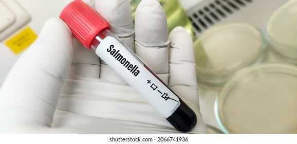 Blood Sample For Salmonella Bacteria Test, Typhoid Fever Test