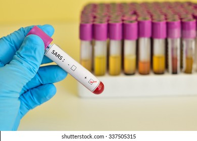 Blood Sample With SARS (Severe Acute Respiratory Syndrome) Virus Positive