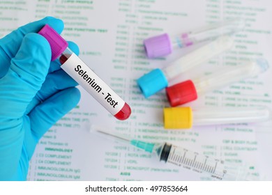 Blood Sample For Selenium Test
