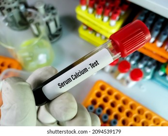 Blood Sample For Serum Calcium Test