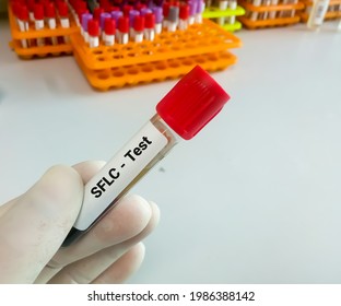 Blood Sample For Serum Free Light Chain Test. Diagnosis For Plasma Cell Disorders 