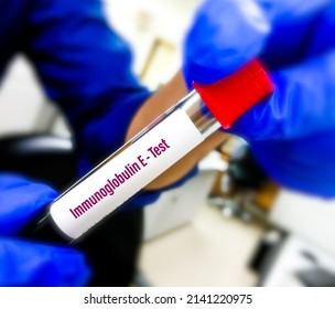 Blood Sample For Serum IgE (Immunoglobulin E) Test, Allergy Testing For Detect Allergen Substance Cause Allergic Reaction